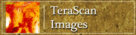 TeraScan Images